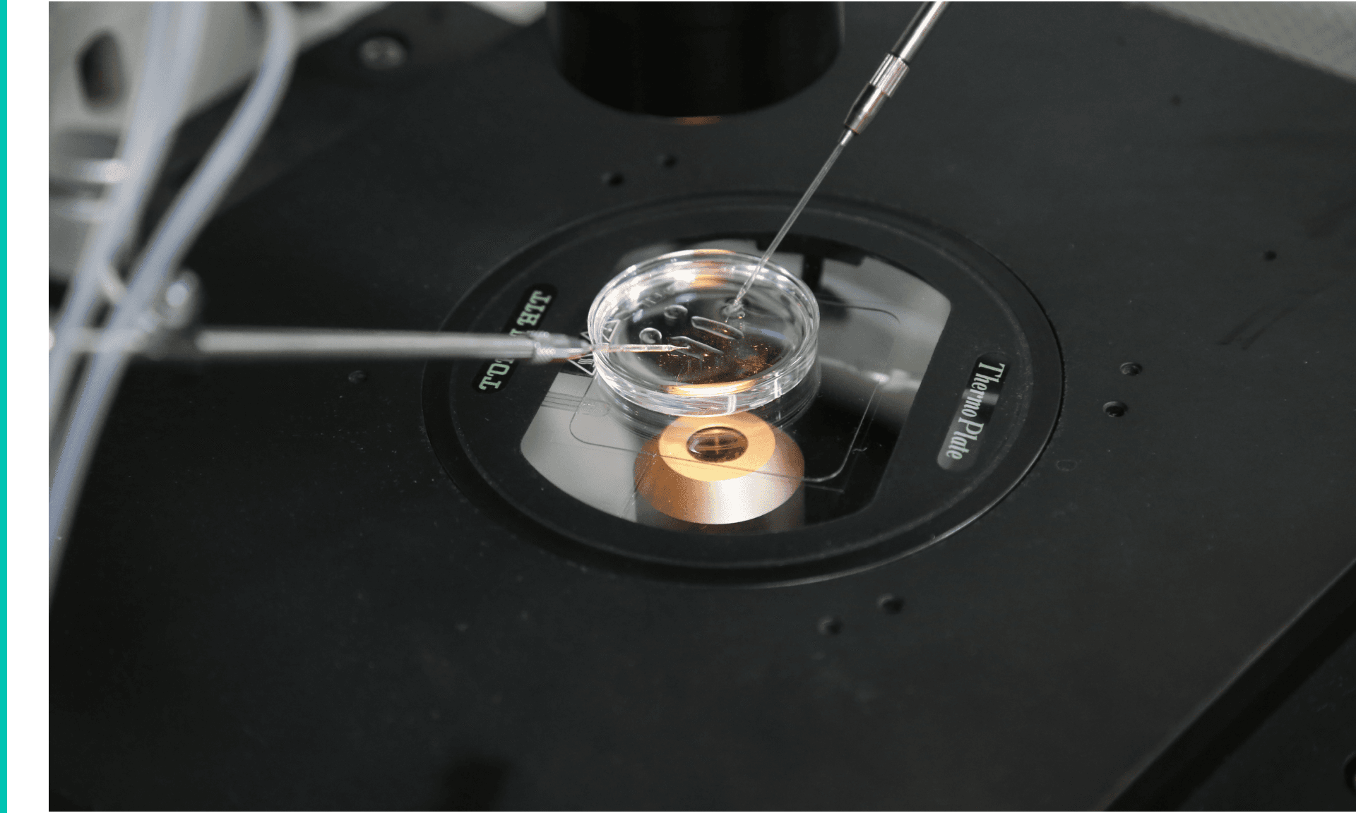 Somatic cell nuclear transfer